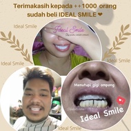 Terlaris Ideal Smile Gigi Palsu Atas Bawah Gigi Palsu Instan Lepas