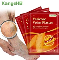 [100% Pure]5 boxes     wish ebay Lazada Joom Varicose Veins Patch 6pcspack