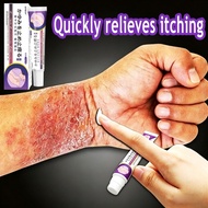 Psoriasis Cream Antifungal cream Eczema cream gatal kulit krim gatal kulit herba cina Ubat gatal 止痒膏