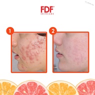 hj_store.my Fdf Skincare  Clarifying  Essence 20g With Free Product Sample