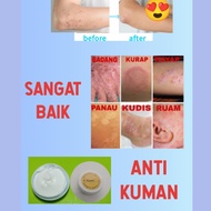 CREAM ECZEMA/KRIM GATAL
