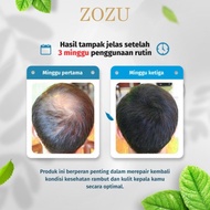 HEMAT Serum penumbuh rambut penumbuh rambut Penumbuh rambut botak