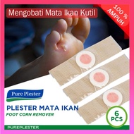 6 Pcs Plester Mata Ikan Obat Kutil Mata Ikan Tahi Lalat Plester Kutil Penghilang Pencabut Kaki Leher