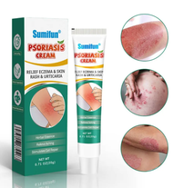 SUMIFUN Psoriasis Cream Effective Gamot Sa Kati Kati Sa Balat Buni hadhad Bungang Araw Ointment