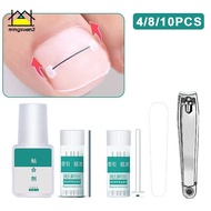 mingxuan2 Ingrown Toenail Corrector Tools Pedicure Recover Embed Toe Nail Treatment Professional Ing