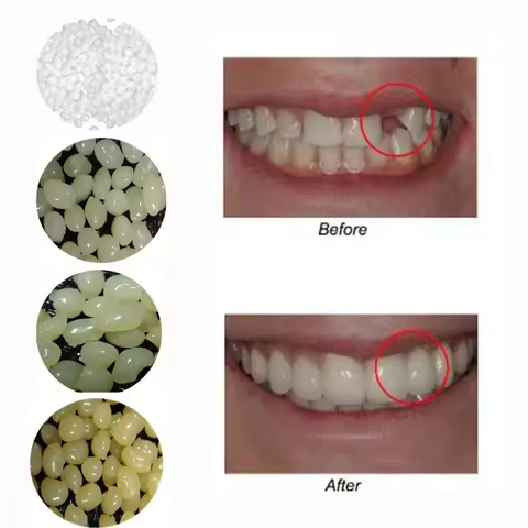 4 Colors Dental Oral False Fake Teeth Tooth Filling Repair Smile Snap on Veneers Dentures Case Paste