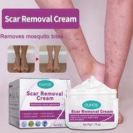 Scar Removal Cream Scar Removal Cream Foot Scar Repair Scar Removal Cream Repair Old Scars