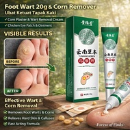 Foot Wart 20g & Corn Remover | Ubat Ketuat Tapak Kaki | Corn Plaster & Wart Removal Cream | Chicken 
