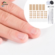 [chulisia] Ingrown Toenail Correction Kit Foot Care Pedicure Tools, Ingrown Toenail Correction Patch