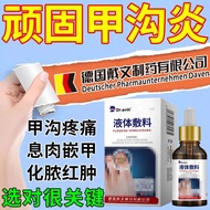 Stubborn Paronychia Nails Ingrown Nails Ingrown Nails Red Swollen Pain Pseudoa Nails Peripheral Care