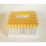 Blood Tube Vacutainer Vacuum Tube Gel Clot Activator SST 8.5ml Collection