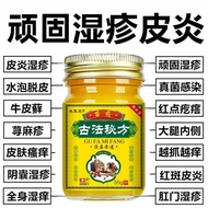 Herbal Skin Itching Anti-Itching Cream Anti-Itching Dry Itching Whole Body Itching External Use Crea