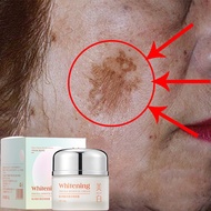 Whitening Krim jeragat Freckle cream krim jeragat paling berkesan lulus kkm jeragat treatment 祛斑霜 pi