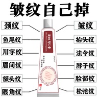 Fade Fine Lines Remove Fine Lines Neck Lines Nasolabial Lines Crow's Tail Lines Forehead Lines Light