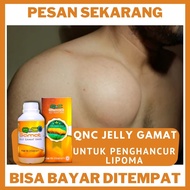 Obat Benjolan Lipoma - Obat Alami Menghilangkan Lipoma Obat Herbal Tumor Lipoma Obat Kelenjar Lipoma