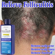 syampoo kelemumur Psoriasis Shampoo Anti Dandruff gatal kepala Itchy scalp Anti-mite kulit kepala be