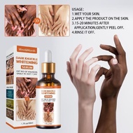 JUADark knuckle whitening serum dilute melanin Joints to black12U 36E3