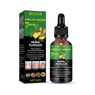 Eelhoe 7วัน Nail Fungus Treatment Repair Liquid Ginger Foot Anti-Fungal Essence Serum Anti Infection Paronychia Onychomycosis Removal Repair Solution Prevent Fungal Growth Hand Feet Care Essence Foot Toe Nail Fungus Removal Serum(50Ml)