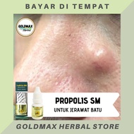 Obat jerawat batu - obat jerawat alami obat jerawat punggung obat jerawat di payudara obat jerawat m