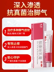 Genuine Cream For Fungal Infection Athletes Foot Anti-itching Peeling Sterilization Hand And Foot Fu