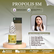 Obat Gusi Sering Berdarah, Obat Gusi Bengkak, Obat Gusi Bernanah, Obat Radang Gusi, Obat Abses Gusi,