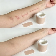 Silicone Self-Adhesive Scar Patch For Wound And Surgical Scar Repair Fading Care Silicone Scar Sheet