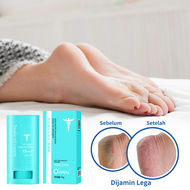 Krim kaki pecah-obat kaki pecah2 dan kering yang ampuh-obat kaki pecah pecah-salep kaki pecah2 dan k