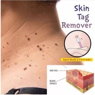 SKIN TAG REMOVER, membuka kutil, ketuat, biji kolestrol