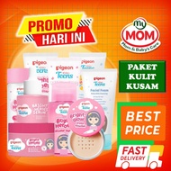 Pigeon Teens Complete Package Bright Heroes Dull Skin - Skincare Facial Treatment For Dull Skin - My