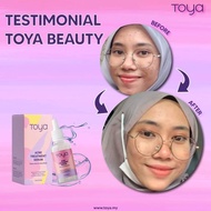 🔥🔥 TOYA BEAUTY SERUM ANTI JERAGAT
