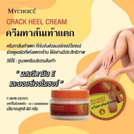 MYCHOICE Chack Heel Cream