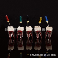 8.9-Dental Material Single 3 Tube Tooth Model Teaching Tooth Hole Root Tube Model Oral Dental Materi