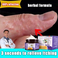 Private antifungal cream anti-itching cream ubat gatal kemaluan Krim gatal kulit Psoriasis Antifunga