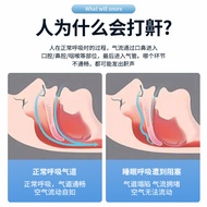 Adjustable Snoring Stopper Snoring Stopper Snoring Silicone Braces Prevent Snoring Snoring20251116ZH