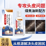 [Ready Stock] Kerosene Tar Lotion Clean Scalp Itching Shampoo Relieve Itching Oil Control Shampoo An