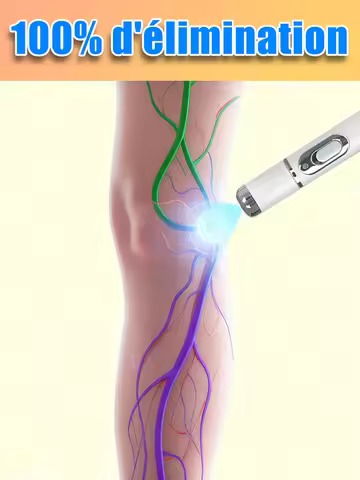 Laser Pen For Treating Earthworm Legs Breakthrough Upgraded Laser Pointer In 2025
