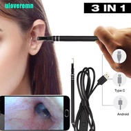 Uloveremn Digital Led Otoscope Ear Camera Scope Earwax Removal Kit Ear Wax Cleaning Tool