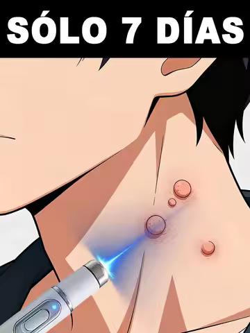 Painless Blue Light Wart Remover Pen - Fast-Acting, Hot Sale! For Feet/Shoulders/Neck/Head,Free Ship