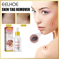 Eelhoe Skin Tag Remover Oil Mole Tag Wart Remover Antibacterial Solution Remove Fleshy Particle Esse