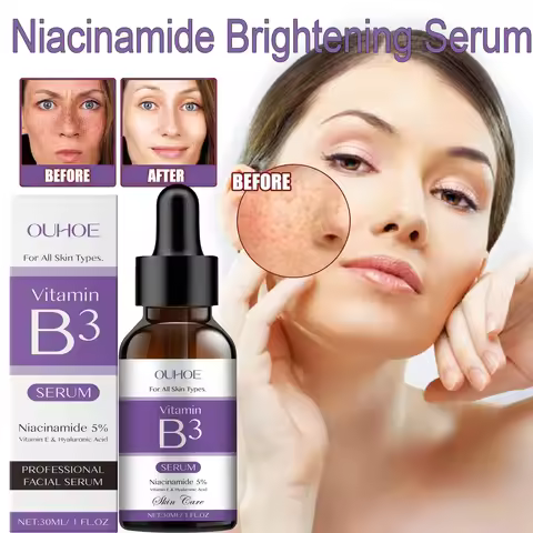Korea Niacinamide Facial Serum Vitamin B3 Wrinkles Pigment Dark Spot Reduce Correcting Glow Serum Fa