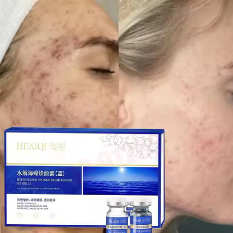 10pcs Copper Peptide Algae Peeling Whitening Melasma Peel Kit Natural Seaweed Bone Plant Extract Mas