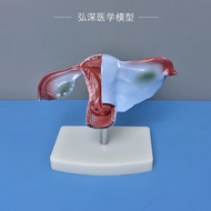 Female uterus model reproductive organs dissection ovaries fallopian tube of obstetrics and gynecolo