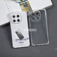 SoftCase Xiaomi 15T Xiaomi 15T Pro Xiaomi 15 SoftCase Airbag Anticrack Thick Protection Casing Xiaom