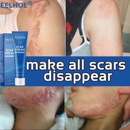 Scar Cream EELHOE Scar Reduction Scar Cream for Burns, Scalds, Especially to Accelerate Skin Repair 