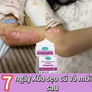 Scar removal cream, scar removal cream, keloid reduction cream, surgical scar fading cream, dark sca