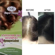 SB ANTI HAIR FALL SHAMPOO