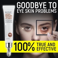 Eyebag Dark Circle Remover Cream Eye Cream for Dark Circle Eye Bags Wrinkles Removal Cream