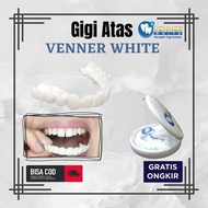 Terlaris Snap On Smile Venner White Perapih Gigi Terlaris