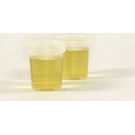 [Art. 2322] urine ibu hamil dbn4924