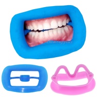 Dental Equipment Dental Retractor Intraoral Lip Cheek Retractor Mouth Opener Cheek Opening Device De